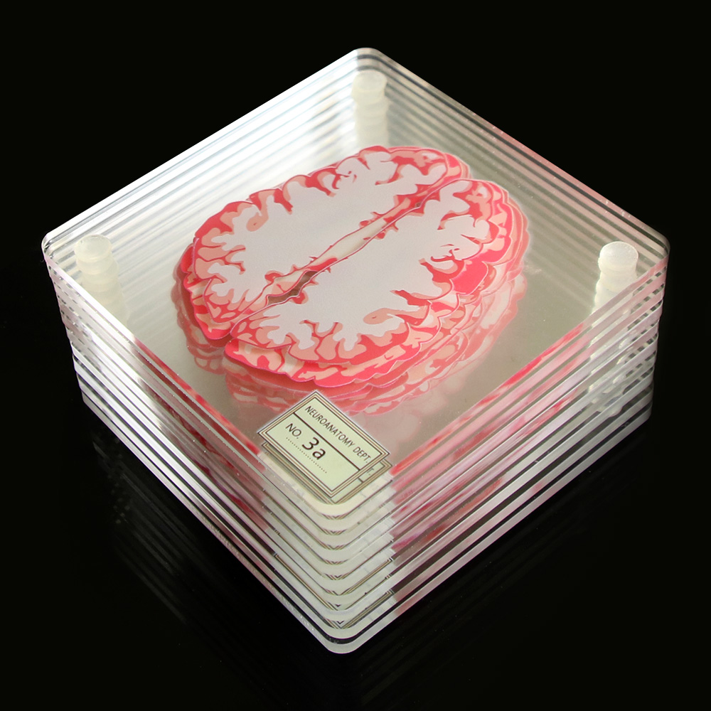 3D Brain Printed Table Coaster 3D Brain Printed Table Coaster